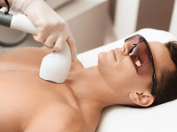 Laser Hair Removal for Men Permanent Hair Removal Toronto